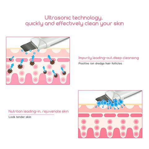 Nettoyeur Visage Profond — Pores Nettes & Peau Lisse Dès la Première Utilisation